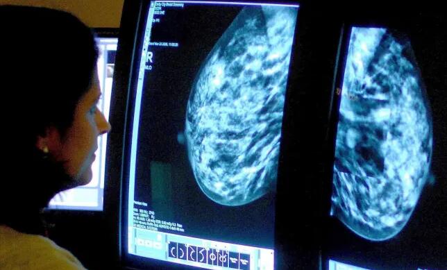 科学家们对早期乳腺癌如何扩散到其他器官有了新的认识