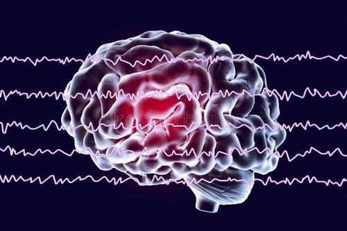 “研究揭示了基于脑电图的脑 机接口的安全漏洞